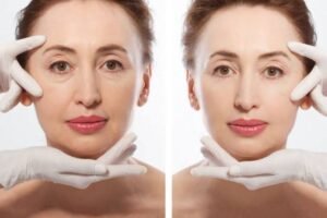 Cosmetic Surgery Prices